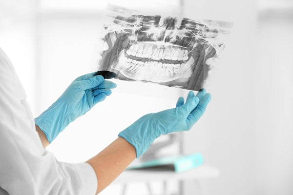 röntgenbild tandläkarmottagning i Malmö