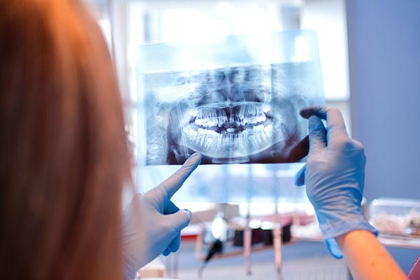 röntgenplåt av garnityr, estetisk tandvård
